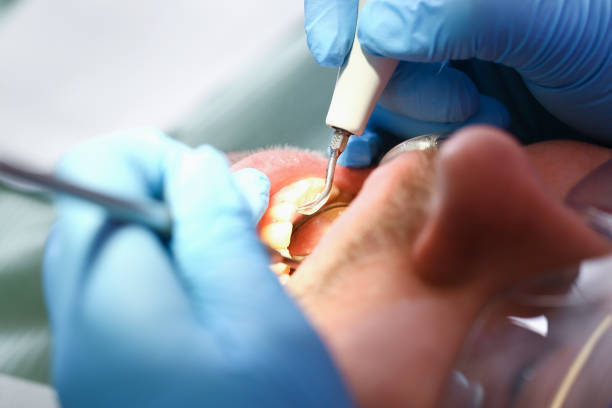Best Emergency Gum Treatment in Claremont, NC