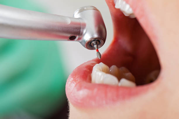 Best Emergency Root Canal Treatment in Claremont, NC